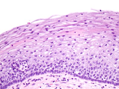 Cuello de útero (histología normal) (9457896149)