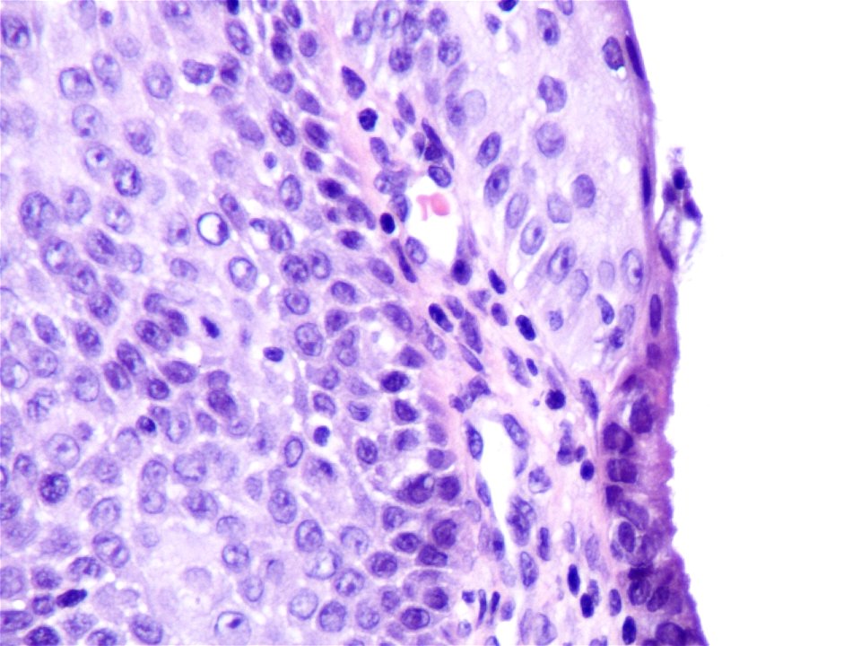 Cuello de útero (histología normal) (9457898085) - Free photos on ...