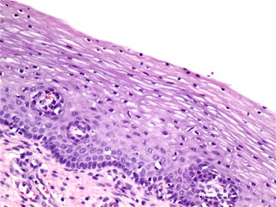 Cuello de útero (histología normal) (9457900983)