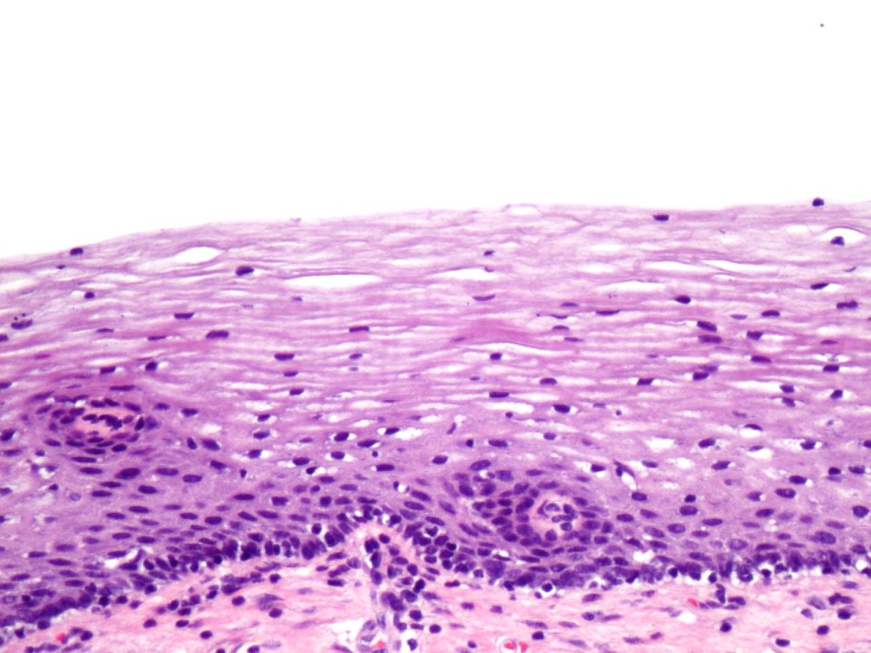 Cuello de útero (histología normal) (9460682780)