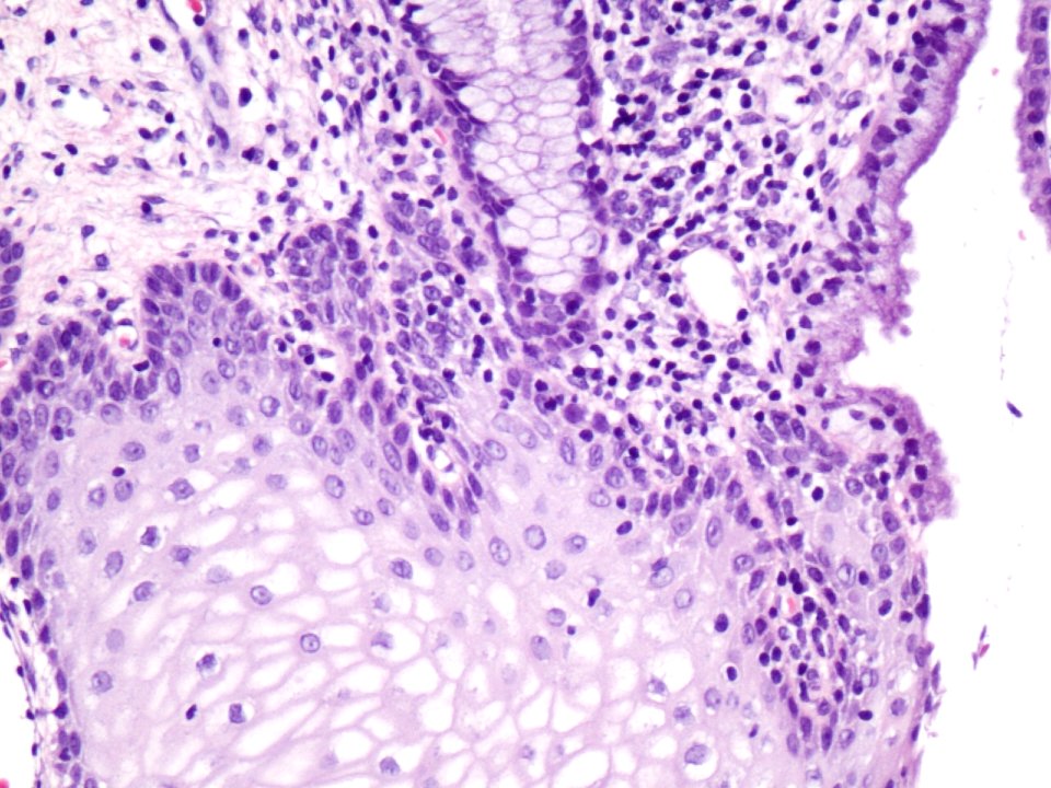 Cuello de útero (histología normal) (9457893961)
