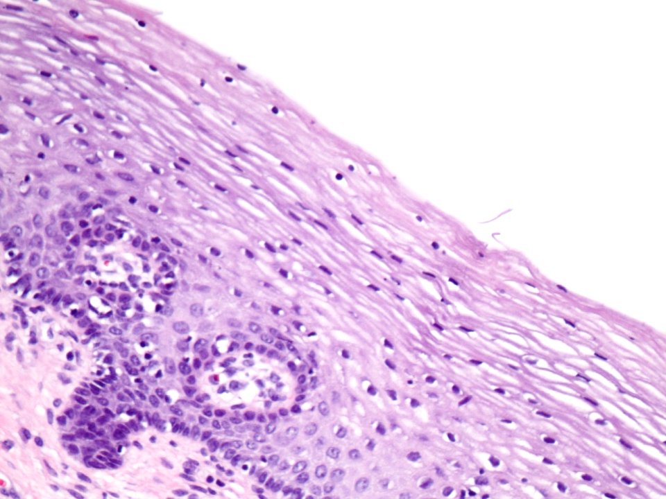 Cuello de útero (histología normal) (9460683644)