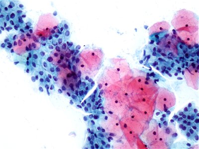 Células endocervicales (9136327089)