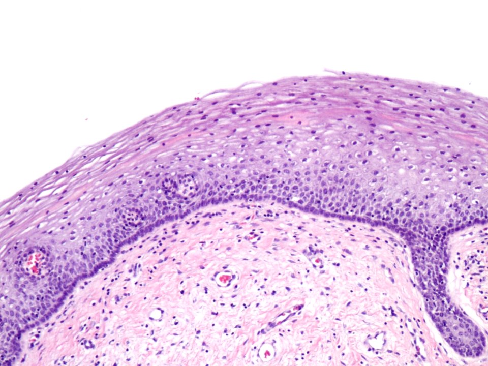 Cuello de útero (histología normal) (9460680794)