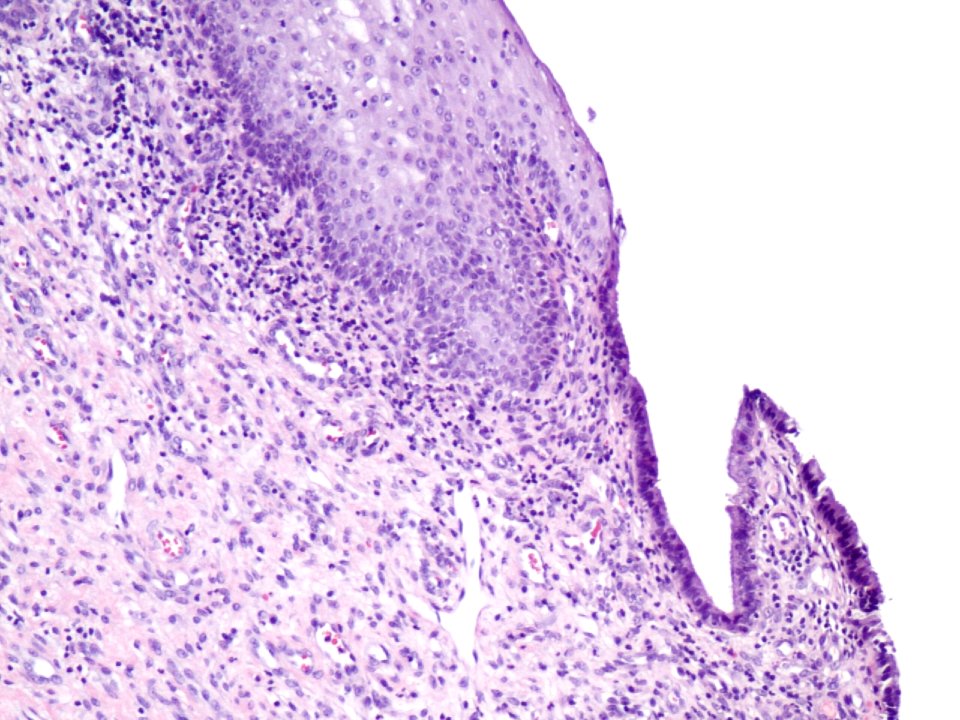 Cuello de útero (histología normal) (9460680556)