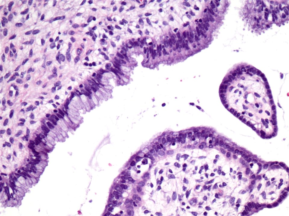 Cuello de útero (histología normal) (9457901985)