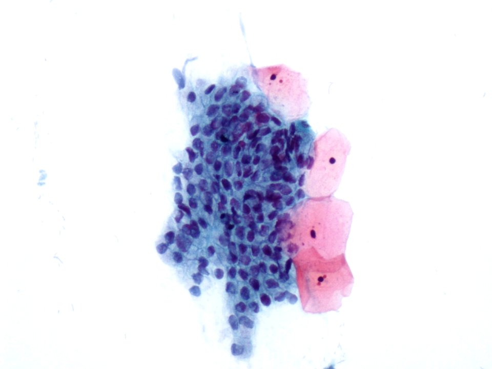 Células endocervicales (9138552442)
