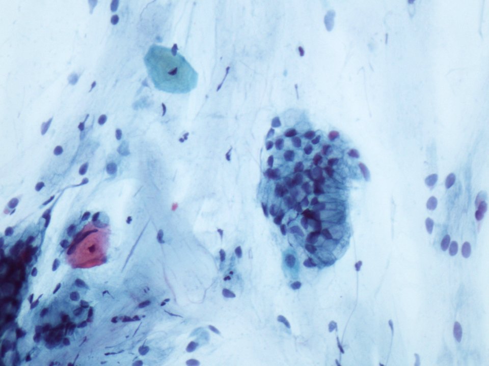 Células endocervicales (9140918882)