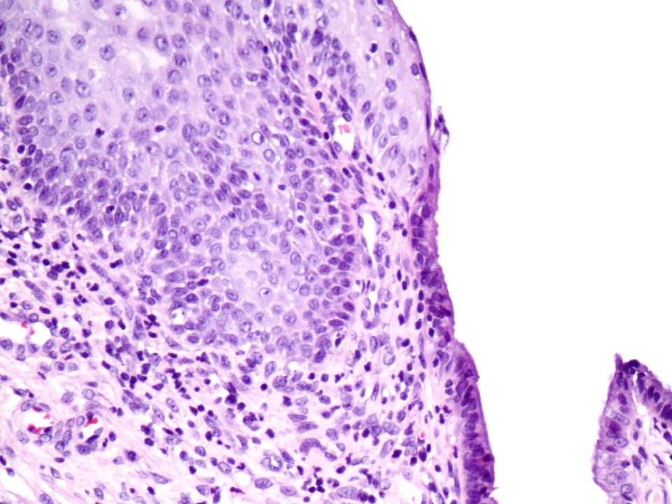 Cuello de útero (histología normal) (9457899135)