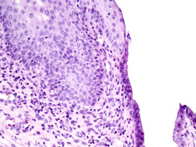 Cuello de útero (histología normal) (9457899135)