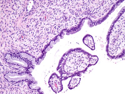 Cuello de útero (histología normal) (9460684466)
