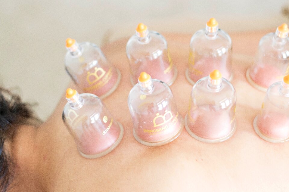 Alternative treatment cupping
