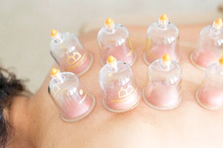 Alternative treatment cupping