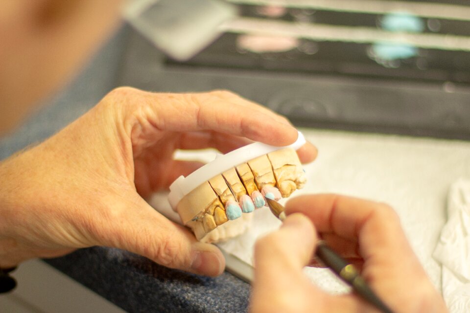 Dentistry smile ceramic