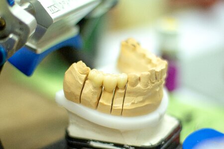 Dentistry smile ceramic photo