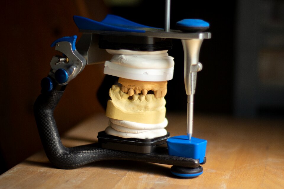 Dentistry smile ceramic