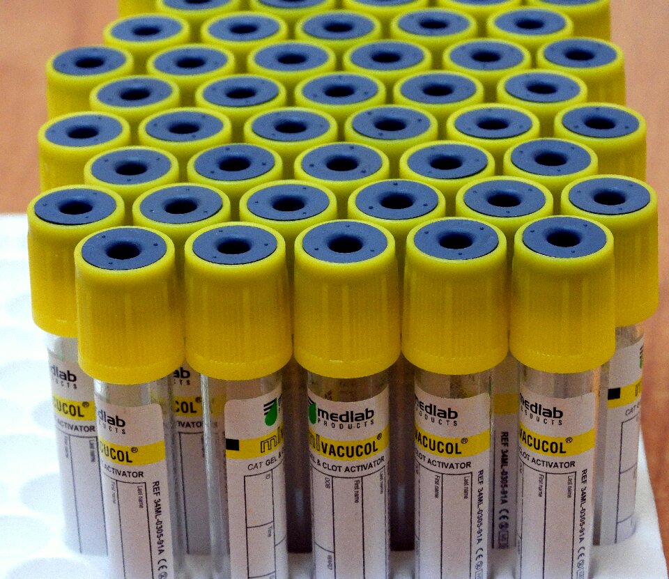 Diagnostics hospital blood