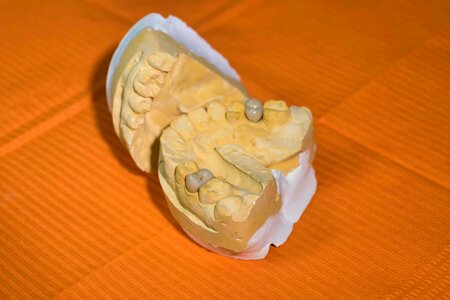Teeth molar reconstruction