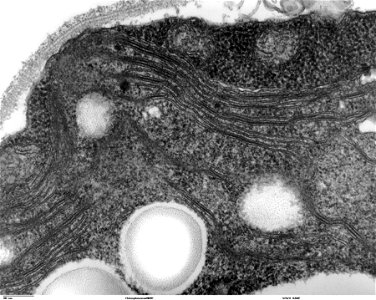 Transmission electron microscope image, showing an example of green algae (Chlorophyta).  Chlamydomanas reinhardtii is a unicellular flagellate used as a model system in molecular genetics work and fl
