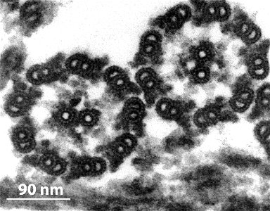 Transmission electron microscope image, showing an example of green algae (Chlorophyta).  Chlamydomanas reinhardtii is a unicellular flagellate used as a model system in molecular genetics work and fl