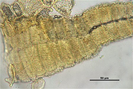 Orthotrichum striatum
