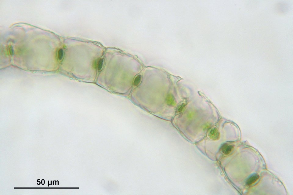 Sphagnum magellanicum
