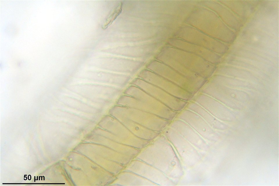 Sphagnum magellanicum