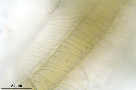Sphagnum magellanicum