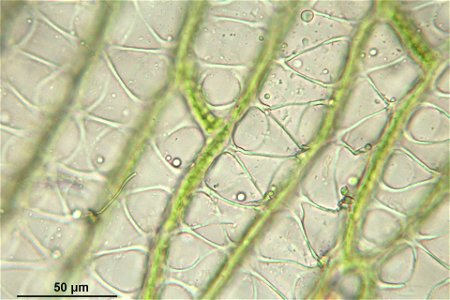 Sphagnum squarrosum