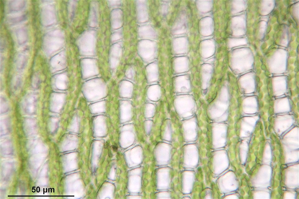Sphagnum squarrosum