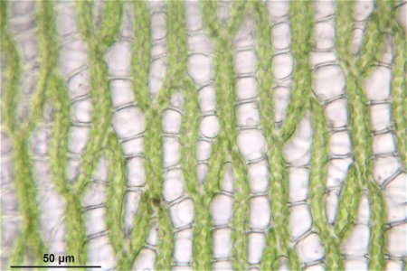 Sphagnum squarrosum