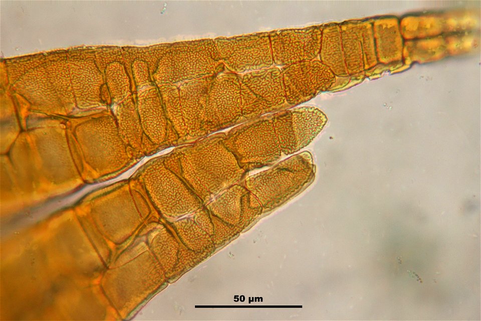 Splachnum sphaericum