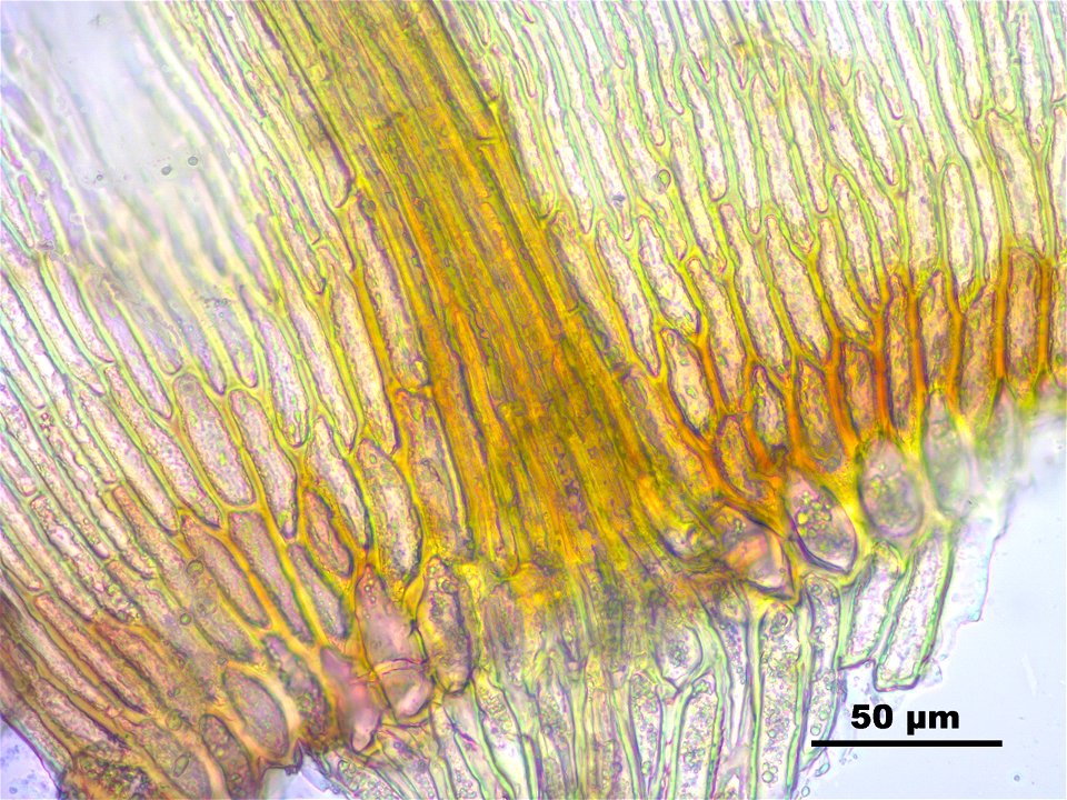 Hamatocaulis vernicosus