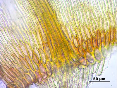Hamatocaulis vernicosus