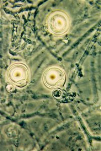 Oospores of Phytophthora palmivora | Read: www.ctahr.hawaii.edu/oc/freepubs/pdf/PD-53.pdf