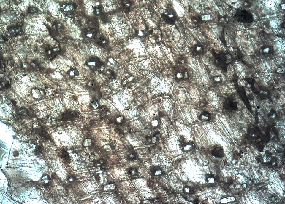 Calcium Oxalate crystals in onion. Crystals known as druse. 100 x magnification