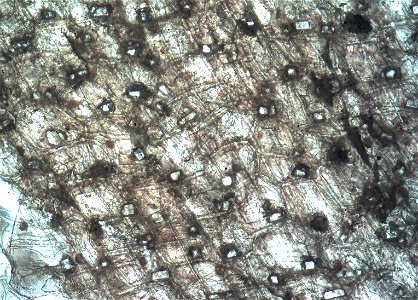 Calcium Oxalate crystals in onion. Crystals known as druse. 100 x magnification photo