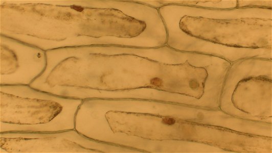 magnification: 200x