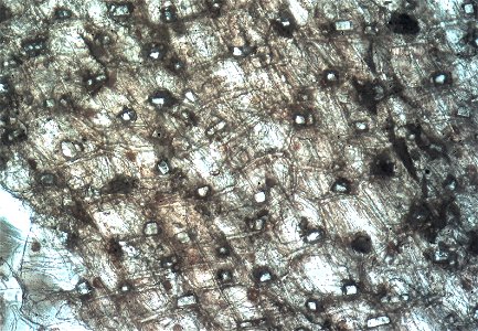 Microscope image 100x of onion scale (skin) showing prismatic crystals photo