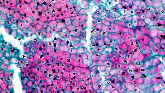 cross section: Zea may embryo
common name: corn grain
magnification: 400x by phase contrast
Triarch quadruple stain