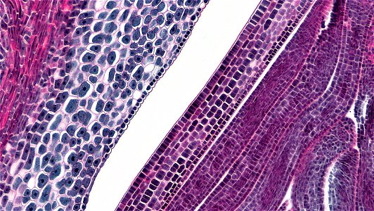 cross section: Zea may embryo
common name: corn grain
magnification: 100x
Triarch quadruple stain