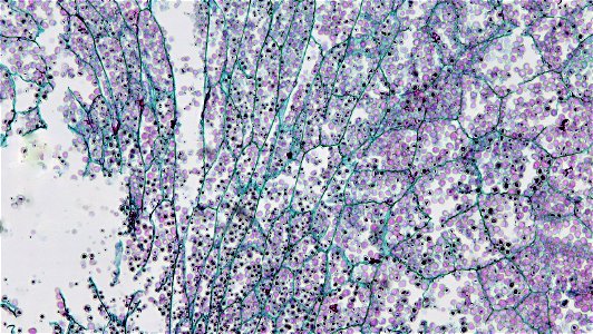cross section: Zea may embryo
common name: corn grain
magnification: 100x
Triarch quadruple stain