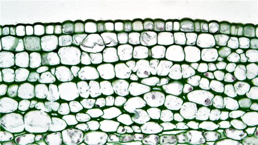 cross section: Richinus stem
magnification: 400x
The epidermis in Richinus consists of a single layer of well cutinized cells.

The cortex is divided into two distinct zones; a large outer zone of thi