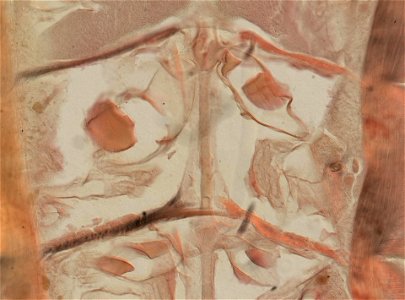 Lumbricus terrestris