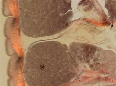 Lumbricus terrestris