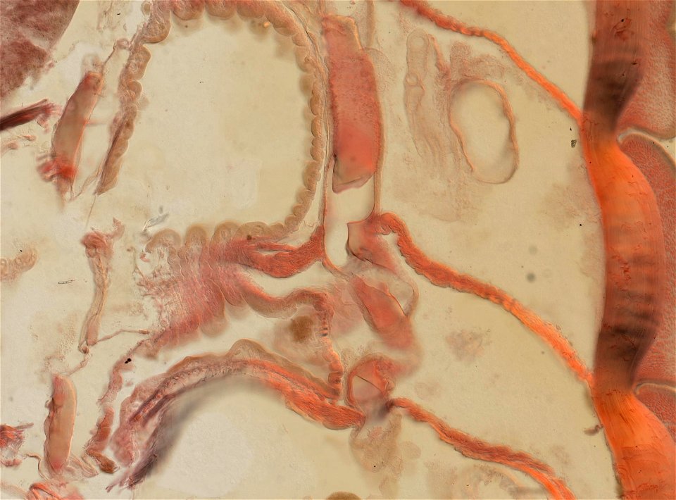 Lumbricus terrestris