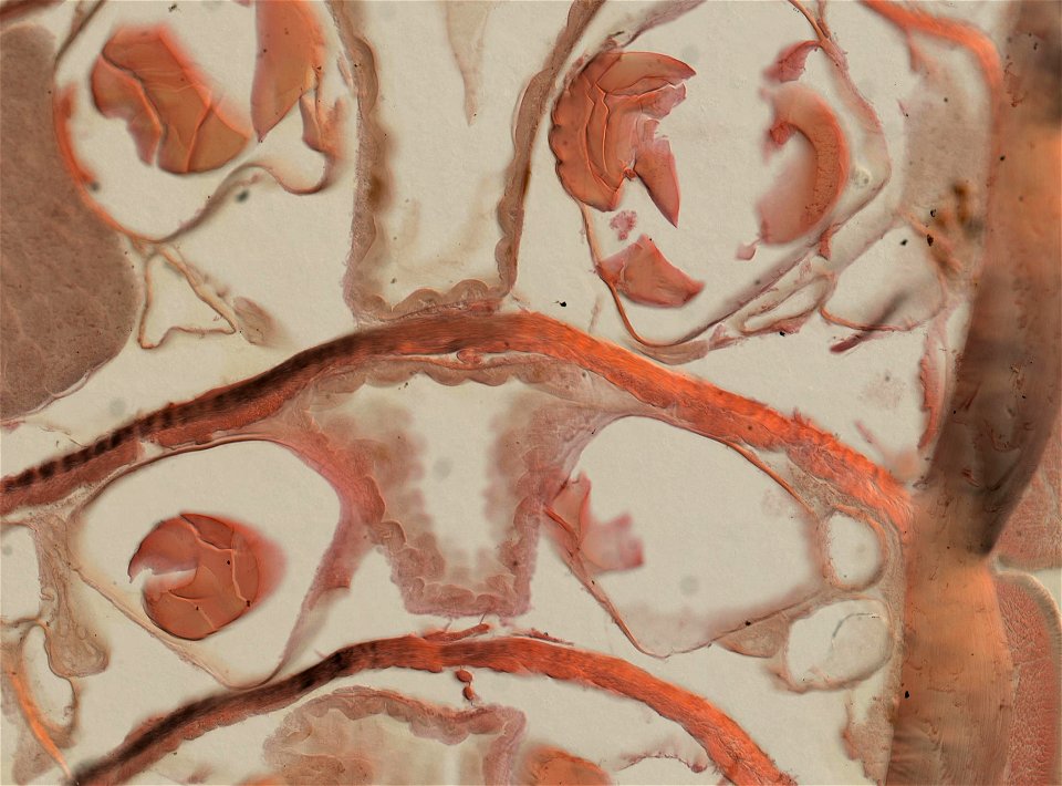 Lumbricus terrestris