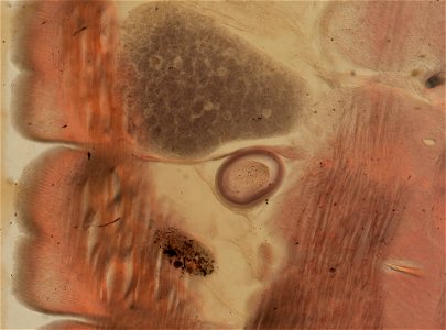Lumbricus terrestris