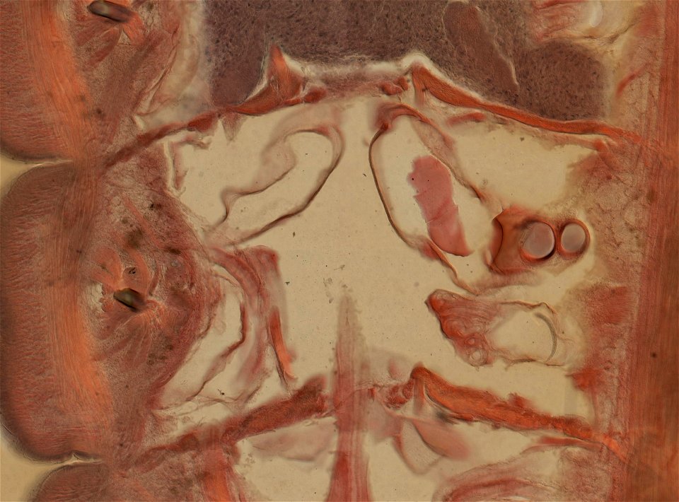 Lumbricus terrestris