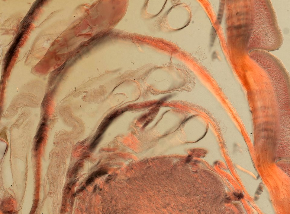 Lumbricus terrestris